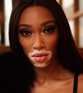 photo Winnie Harlow