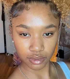 photo Brace Face Laii