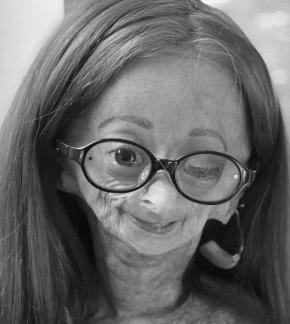 photo Adalia Rose